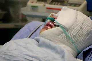 كمیسیون زنان: پاشیدن اسید بر سر و صورت ۴ زن کرد در ماه مبارك رمضان